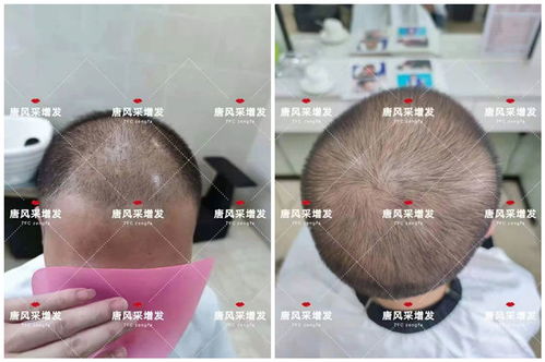 入秋的第一款精品假发，让心情甜过奶茶
